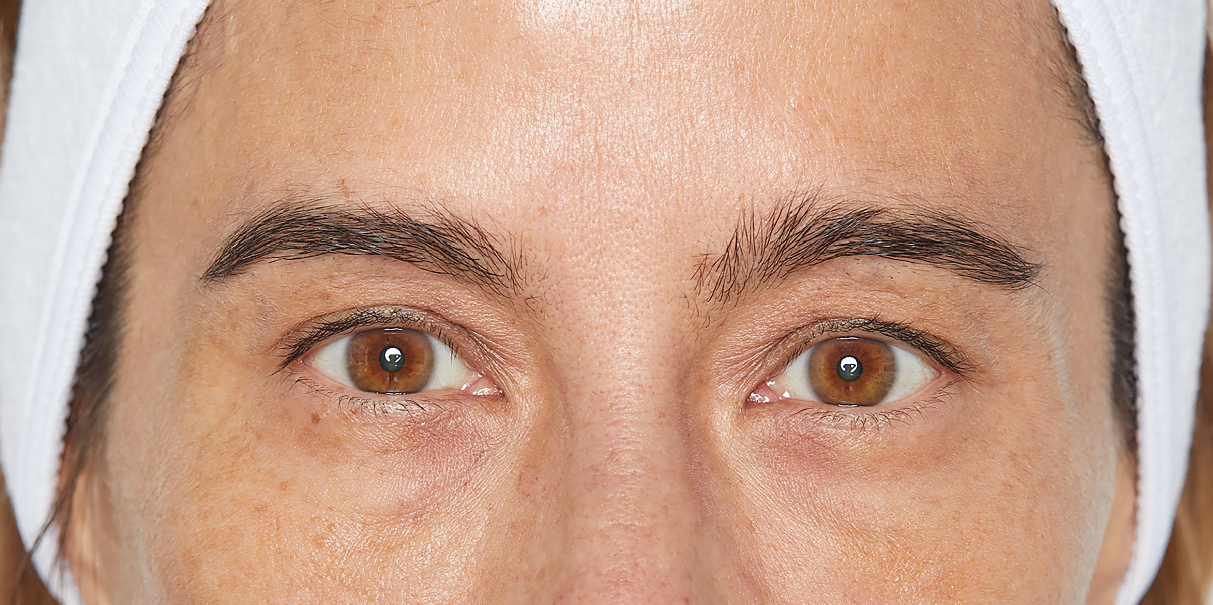 Brown eyes and surrounding skin with visible under-eye creases, freckles, and white headband across forehead