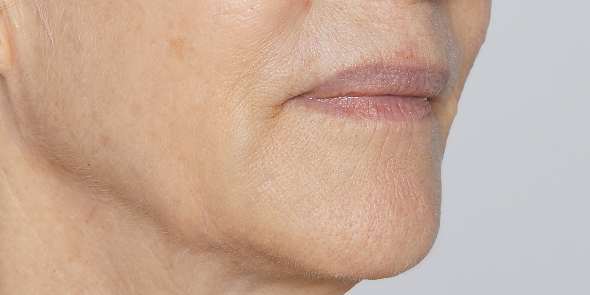 Older person's lower face showing mouth, chin and skin texture with fine lines and visible pores.