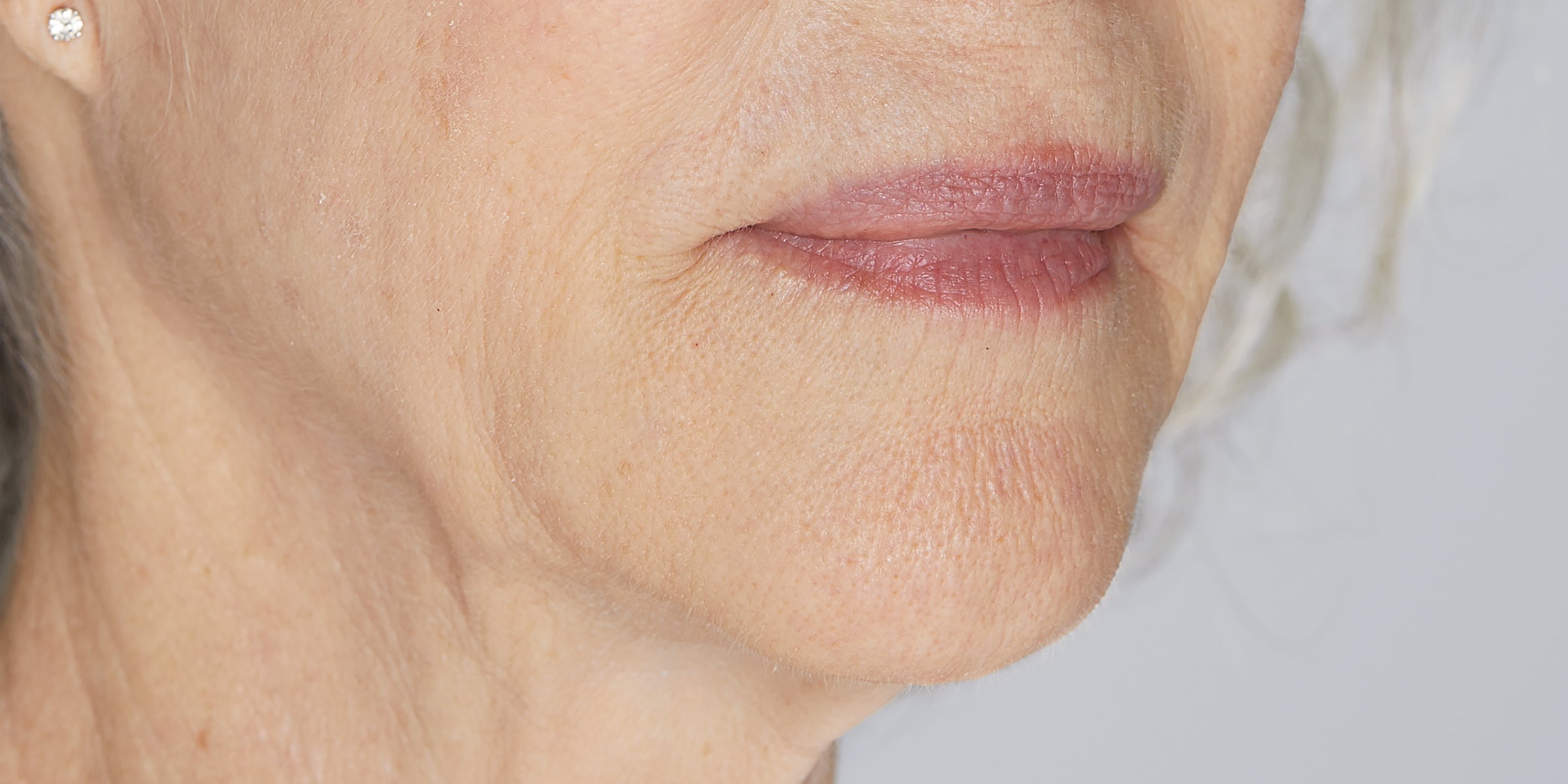 Close-up of an older woman's lower face and neck with lips, chin, fine wrinkles and a diamond stud earring.