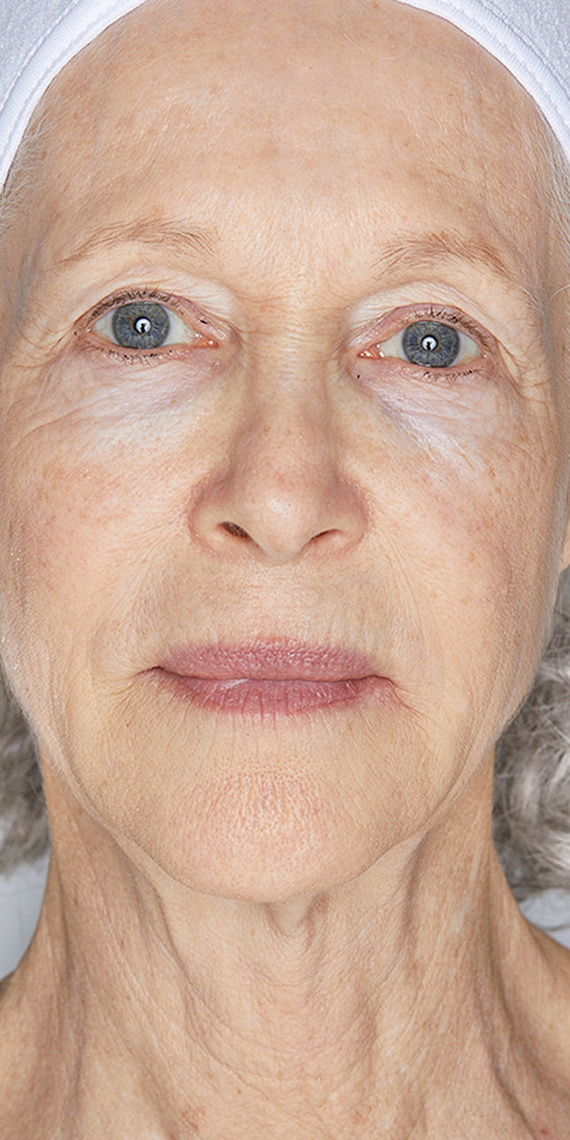 Clinical study before: Clinical study image