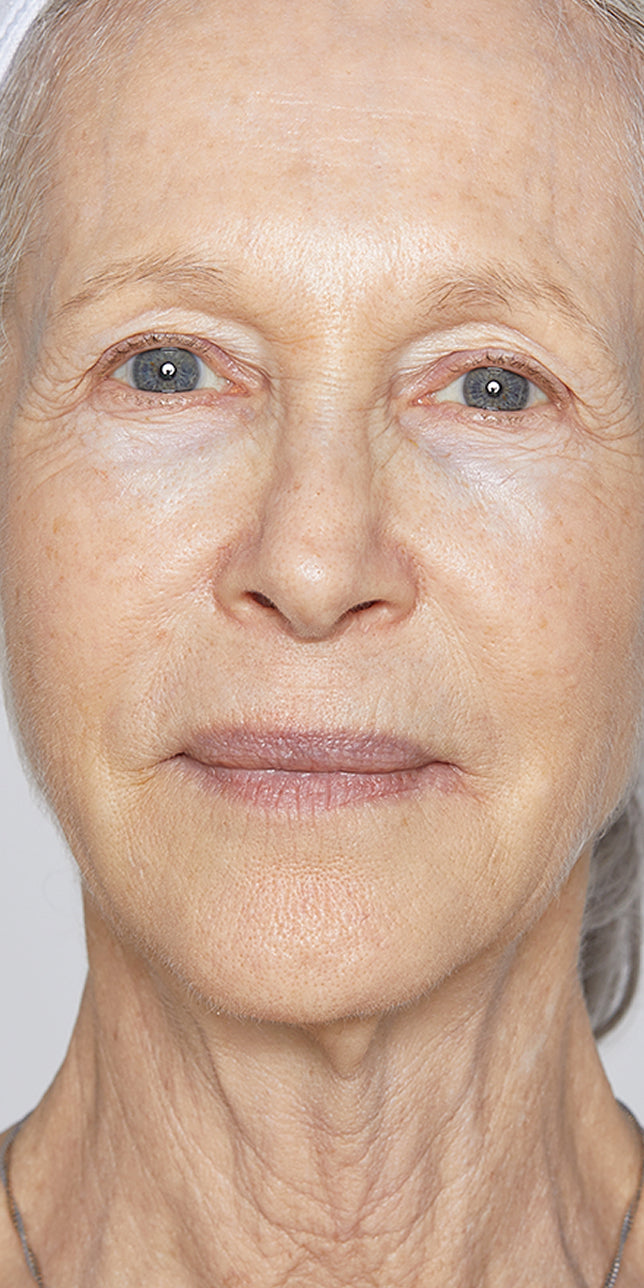Clinical study after: Clinical study after image