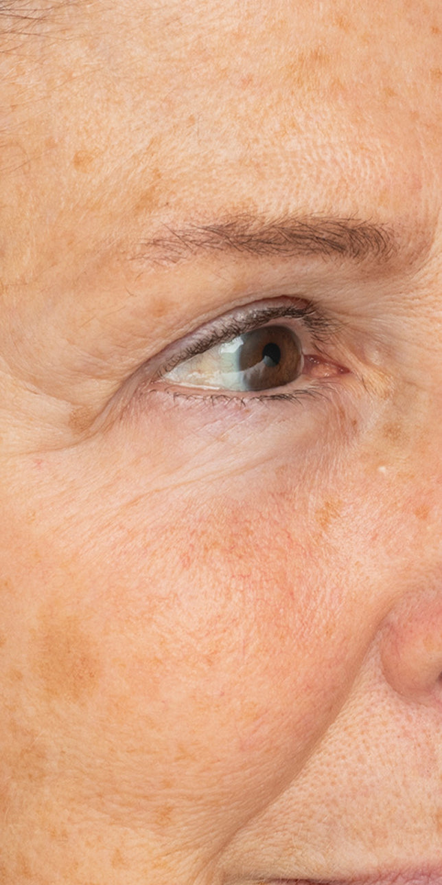 Clinical study after: Clinical study after image