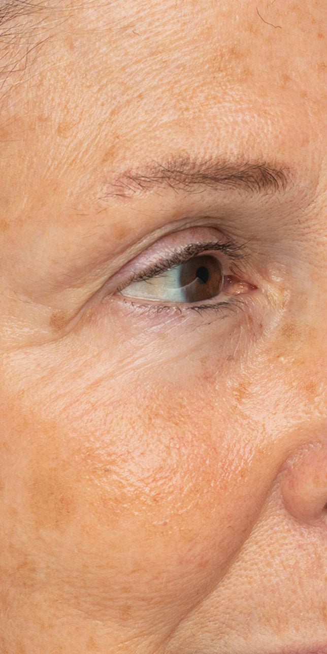 Clinical study before: Clinical study image