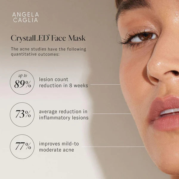 Model close-up with Angela Caglia CrystalLED Face Mask: up to 89% lesion reduction in 8 weeks; 73% and 77% improvements.