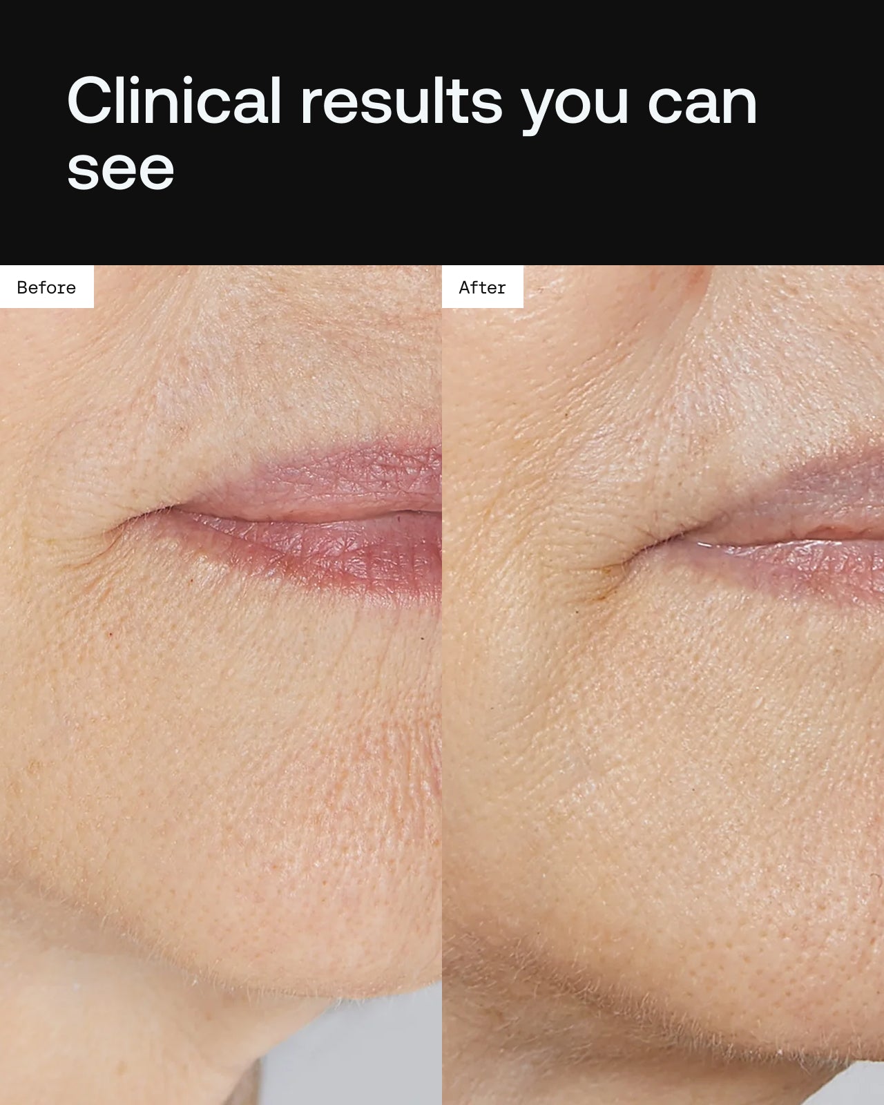Cell Forté Serum | Human Stem Cell Conditioned Media – Angela