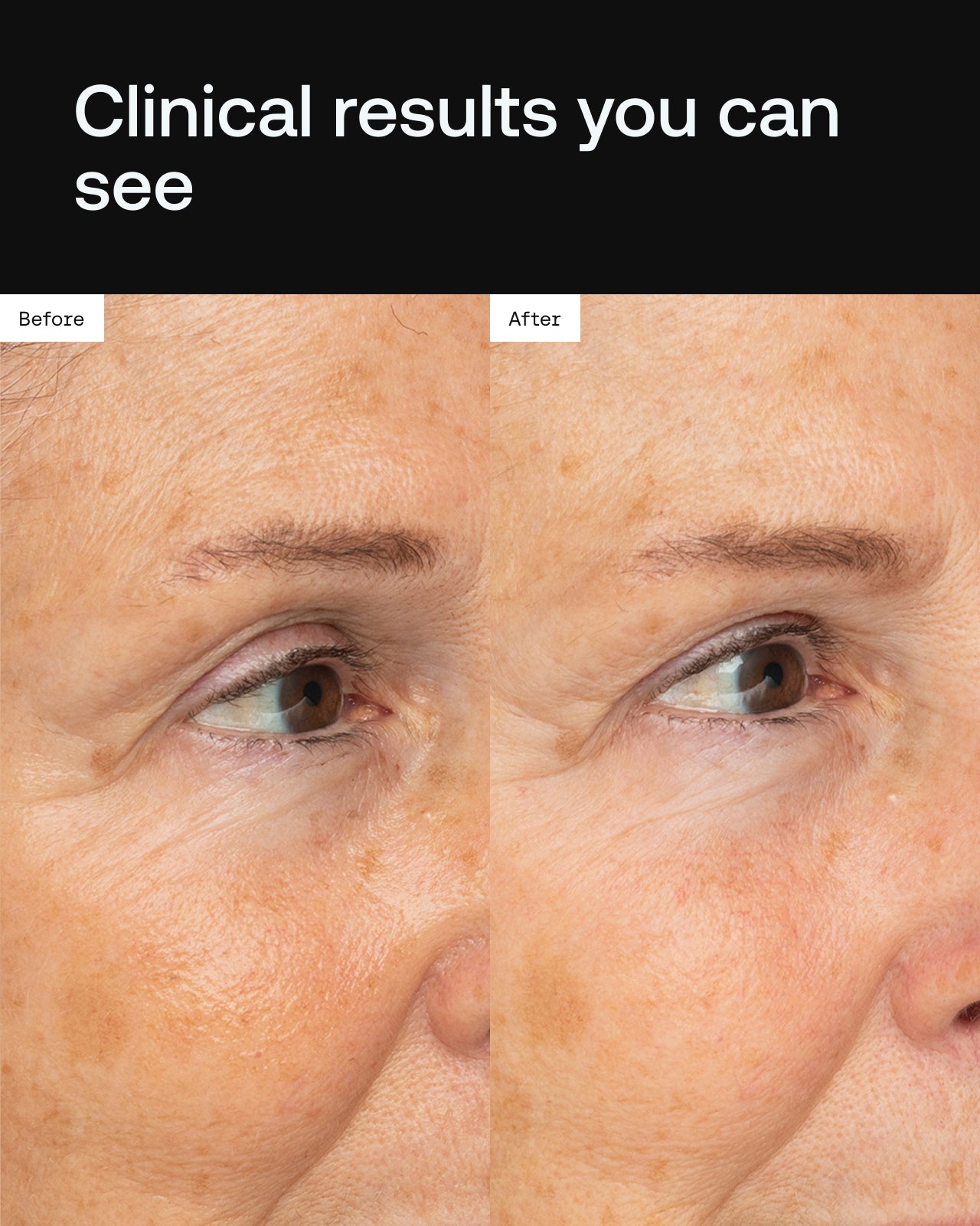 Stem Cell Eye Cream | Eye Crème – Angela Caglia – Angela Caglia