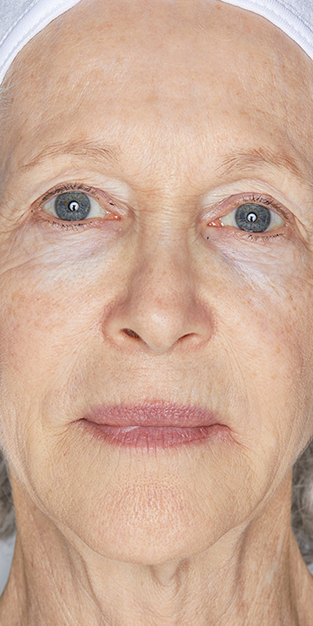 Clinical study before: Clinical study image